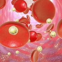 Nanoparticles show promise as a treatment for celiac disease
