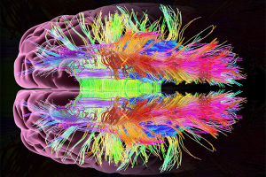 A digital image of a human brain with colorful neural pathways highlighted, showing intricate, multicolored lines representing brain connectivity over a translucent pink brain structure on a black background.