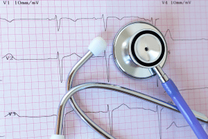 A stethoscope rests on top of a printed electrocardiogram (ECG) chart, showing a series of heartbeats with a grid background and labeled measurements.