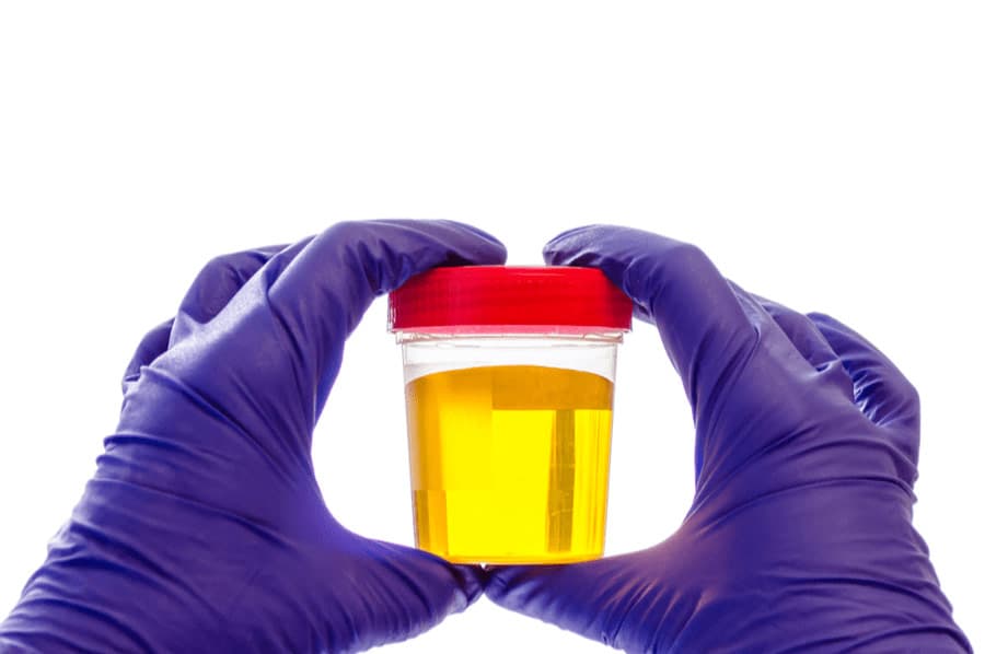 How well do urine tests measure gluten in a gluten-free diet?